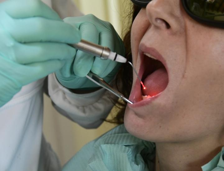 Laser in odontoiatria. Dott. Alessandra Cateni, odontoiatra Cascina, Pisa